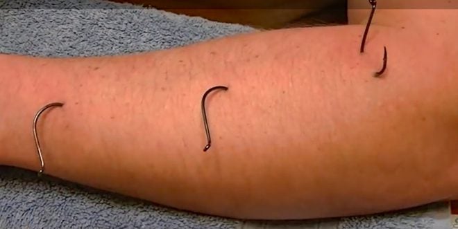 Watch: Guy Sticks Fish Hooks Into His Arm, Then Removes Them 