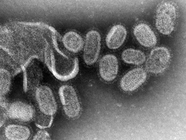 World Facing Possible Flu Pandemic