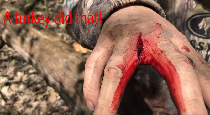 A “Dead” Turkey Can and Will Hurt You A “Dead” Turkey Can and Will Hurt You